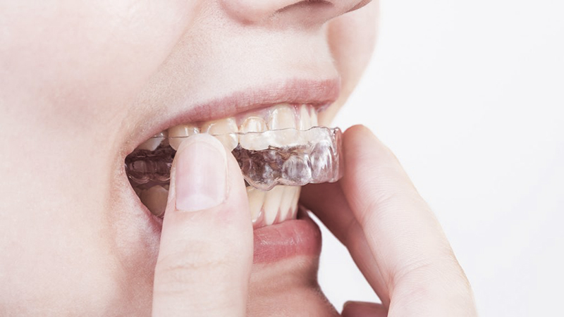 آیا همزمان با ارتودنسی، عمل بینی امکان‌پذیر است؟